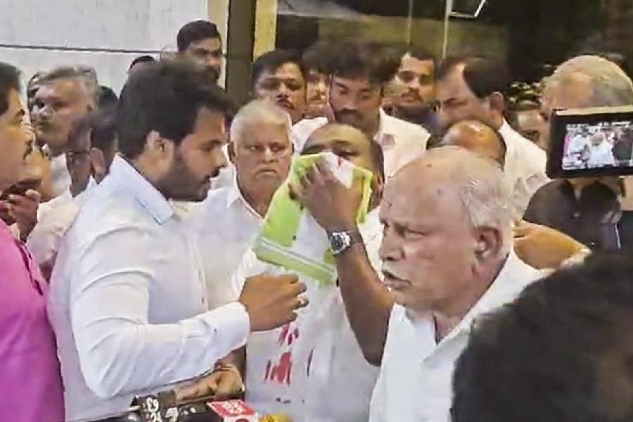 Kumaraswamy hospitalised HD Kumaraswamy hospitalised