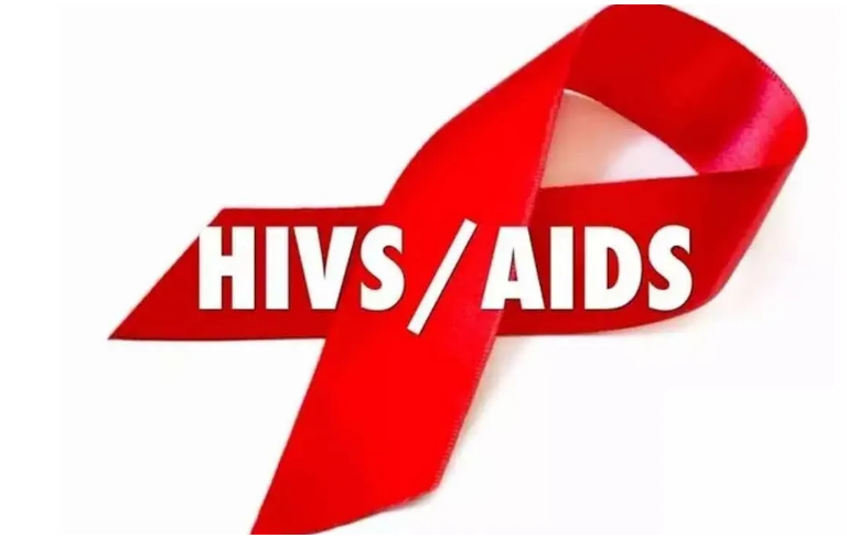 HIV AIDS